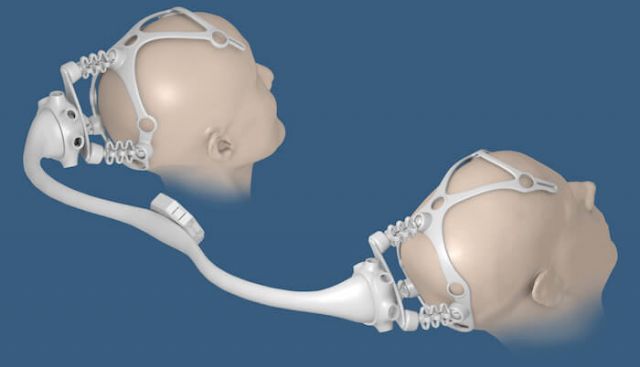 A 3D representation of a custom BCI